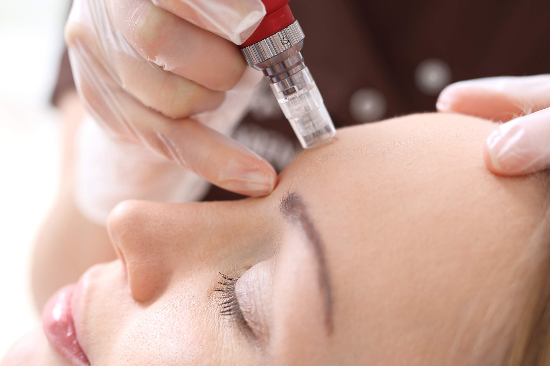 microneedle new jersey