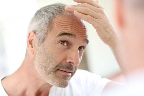 hair loss