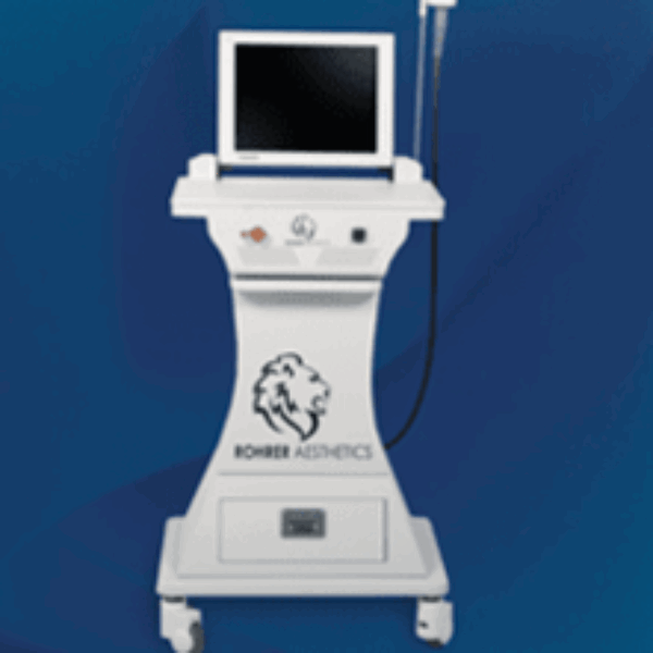 Radio Frequency (RF) Microneedling