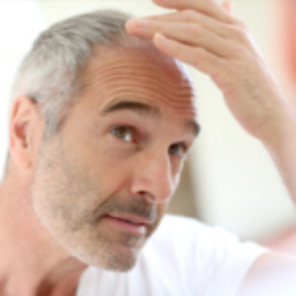 Alma TED™ Hair Loss Treatment