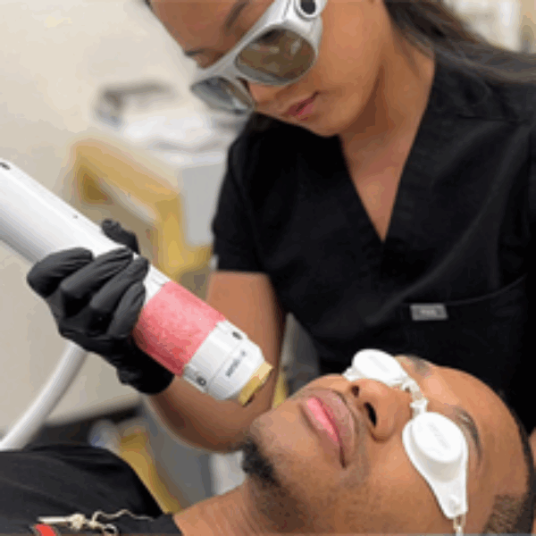 Aerolase® Neo Laser Treatment