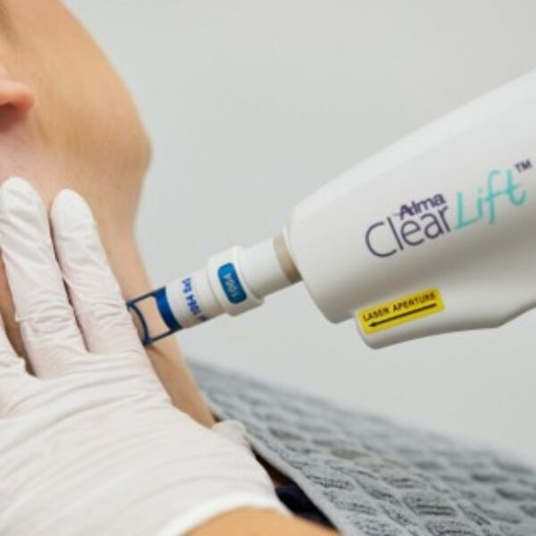 ClearLift™ Laser Treatment